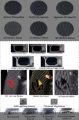 Infinity Billet Metal Grip - Machined Textured- 172 - 172GRIP